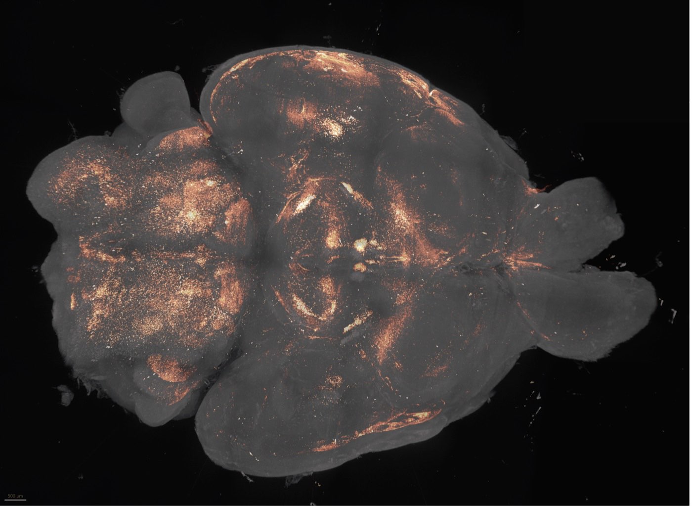 Whole-brain lightsheet microscopy image of an aged mouse brain, showing neural coordination hubs.