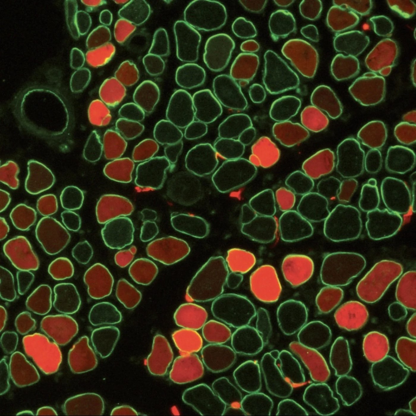 Fluorescence imaging of skeletal muscle showing efficient gene therapy delivery by a new vector platform.